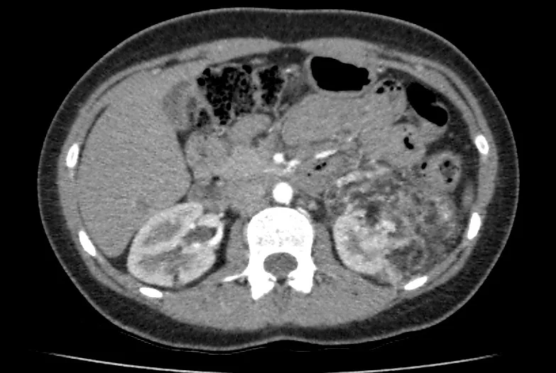 Long case example 3