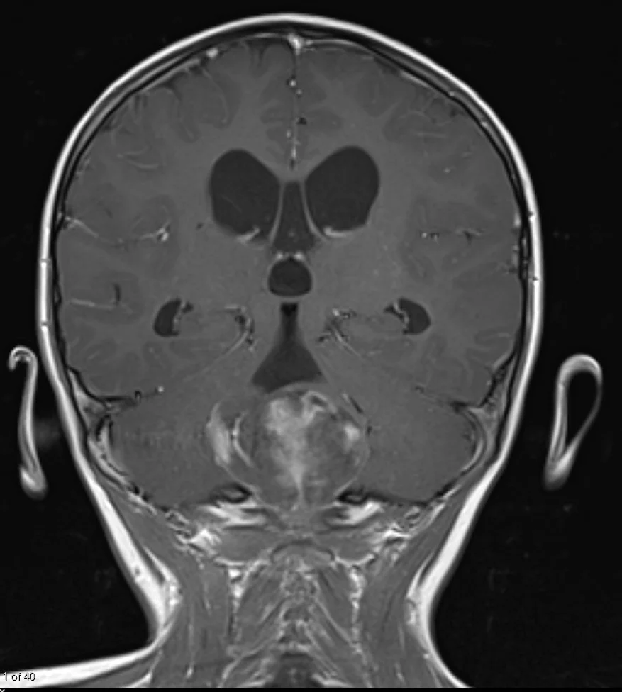 Long case example 4