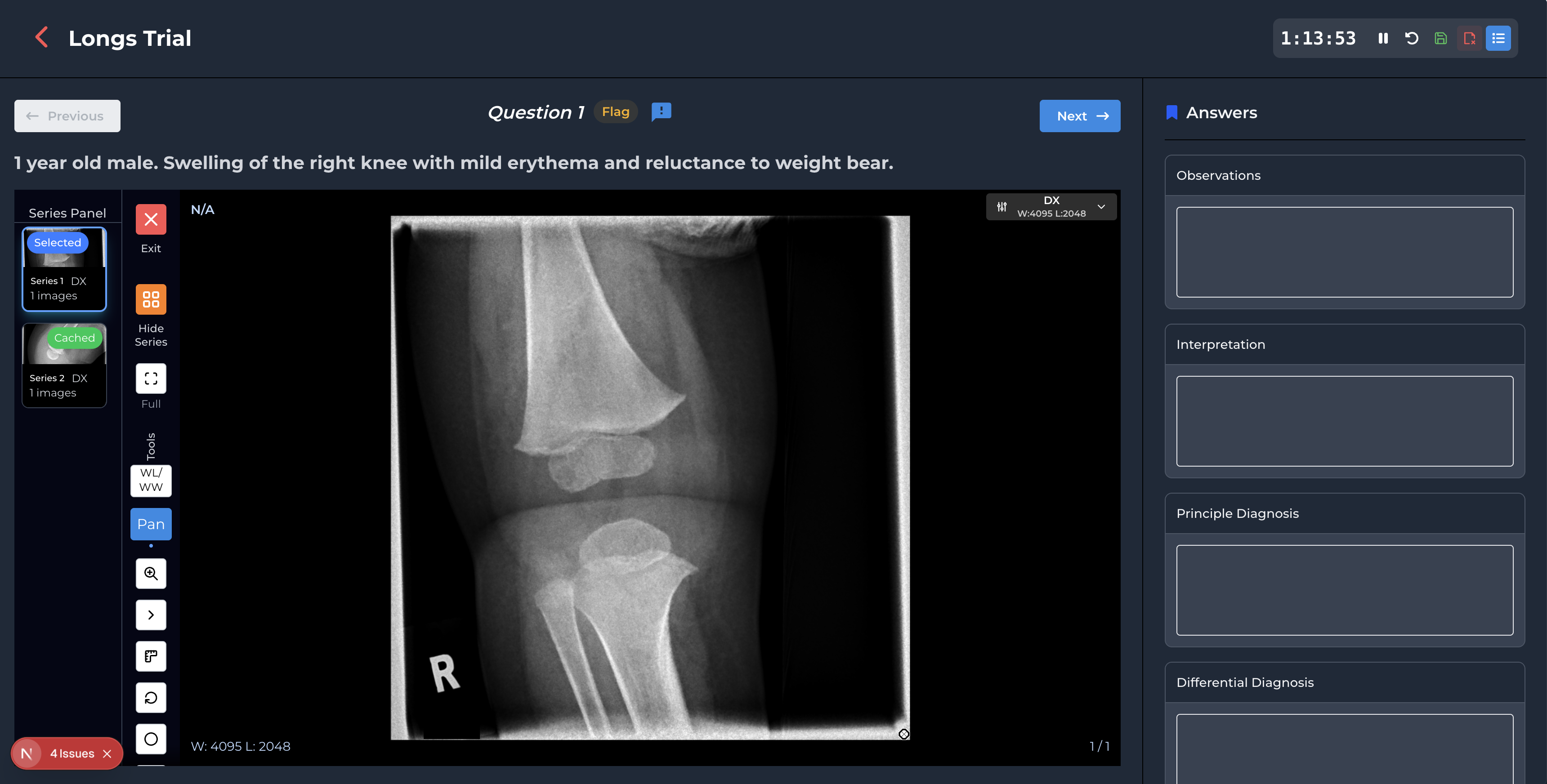 Longs Trial