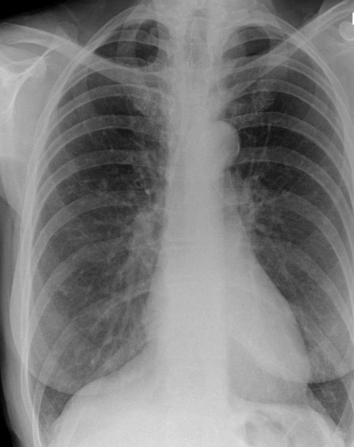 Short case example 1